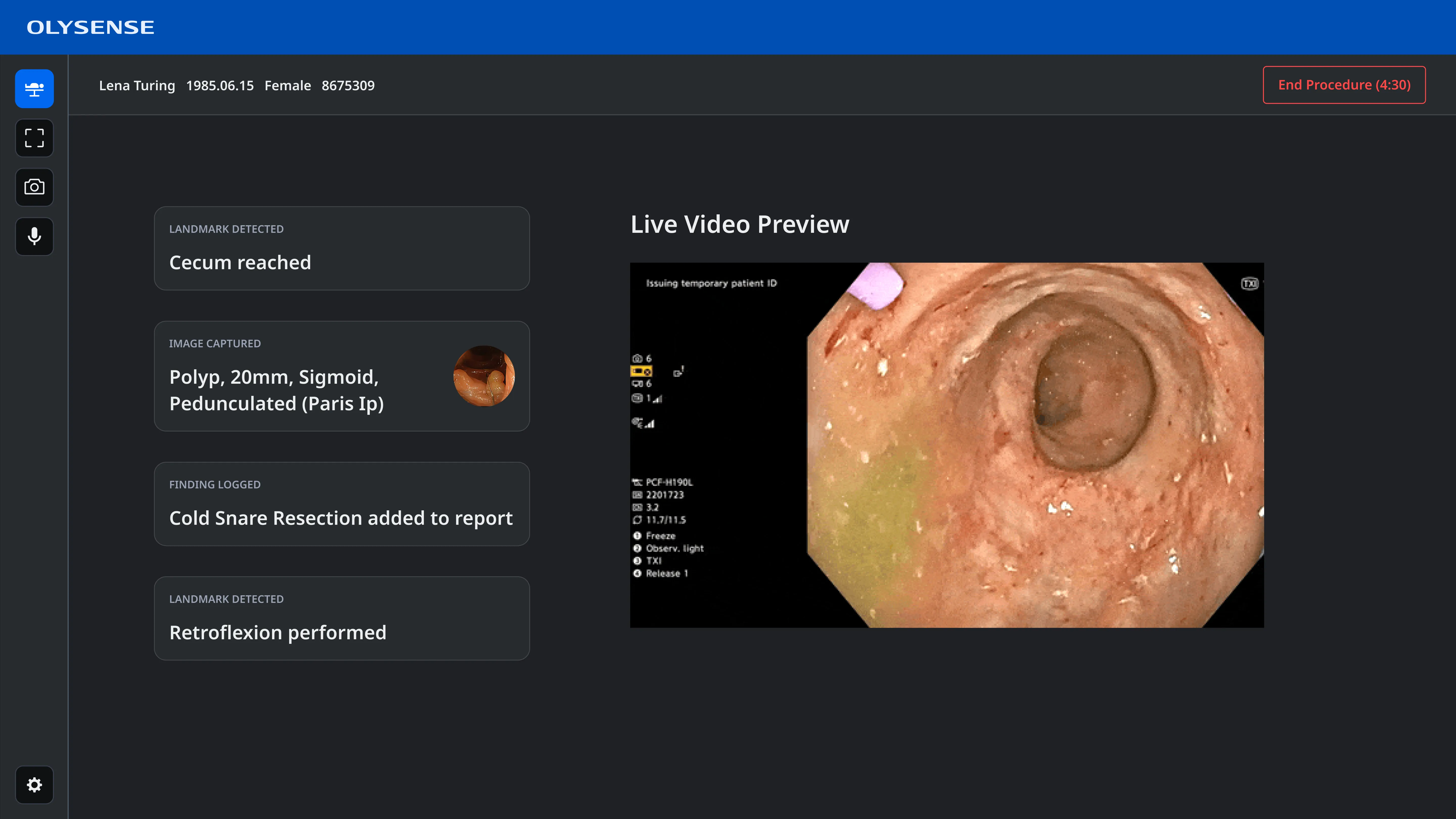 a screenshot of the new intra-procedure page