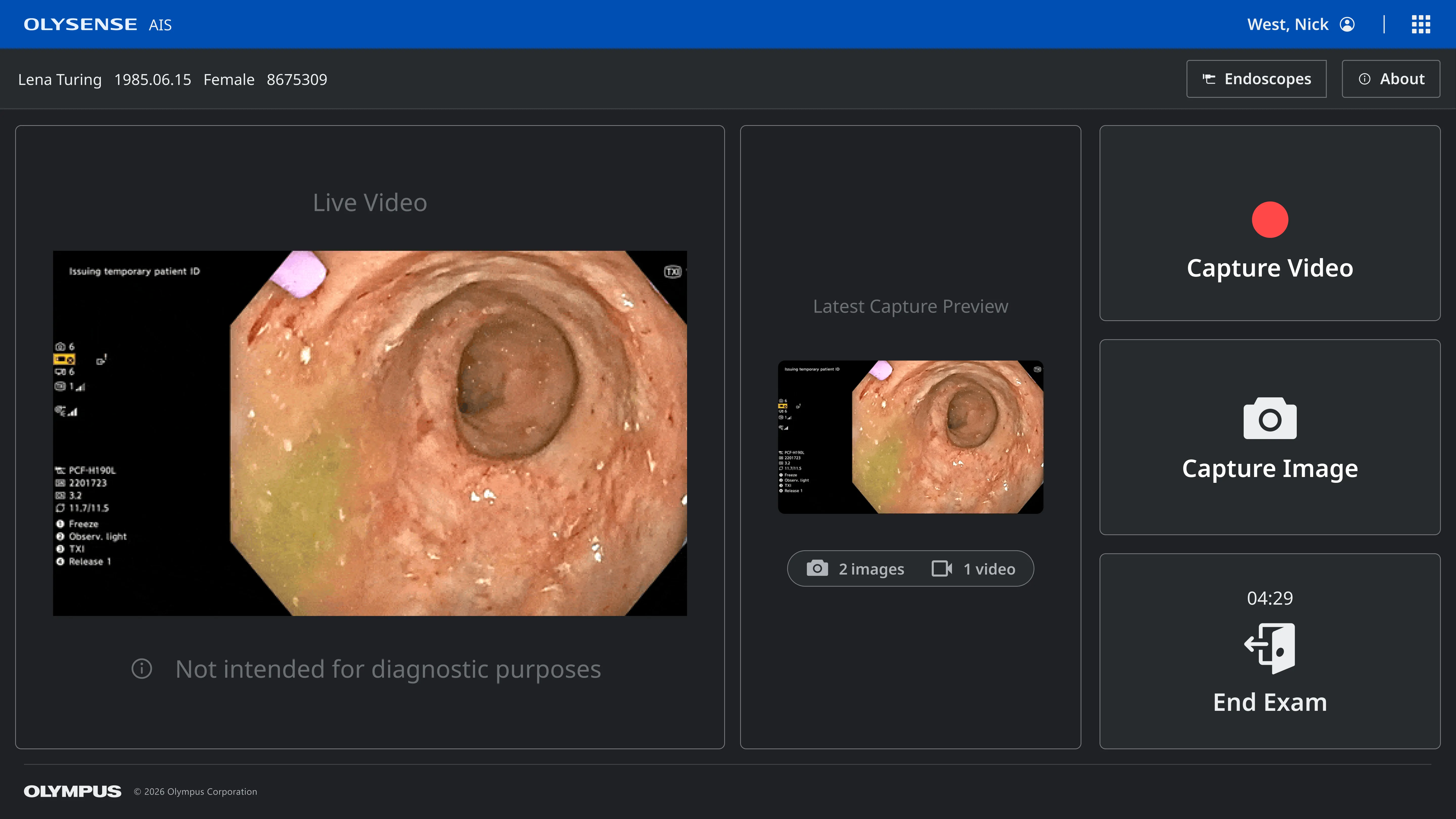 A screenshot view an image from the endoscope and buttons to capture video, capture an image, or end the exam