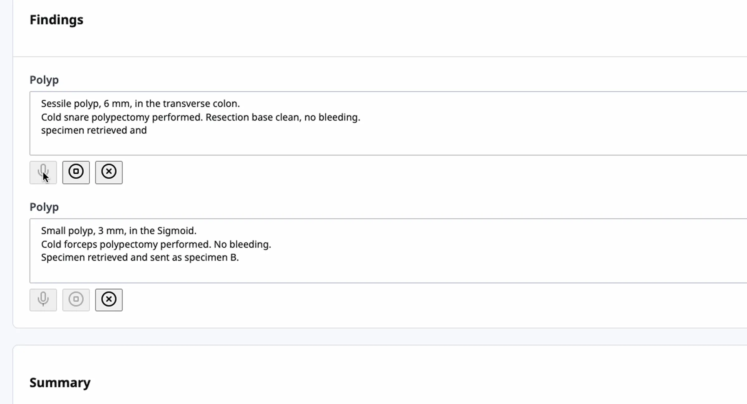 Cover image for Speech-to-Text Prototype